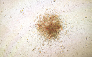 Scientific image: colony of human hematopoietic stem cells